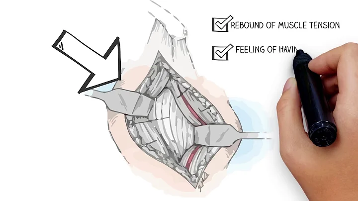 Multimodal Pain Management