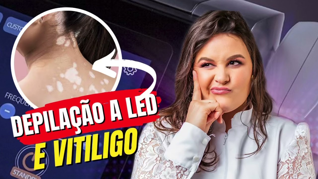 QUEM TEM VITILIGO PODE FAZER DEPILAÇÃO? #vitiligo - YouTube