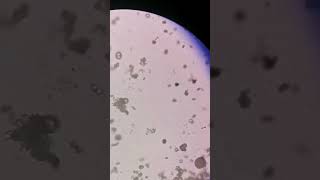 urine under the microscope #laboratory #microscope #mls #cls #medtechstudent