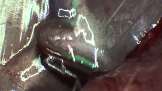 Augmented Fluorescence Videoangiography