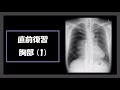 直前復習04 胸部 (1)