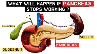 What will happen if pancreas stop working !? Exocrine pancreatic insufficiency EPI !!!..