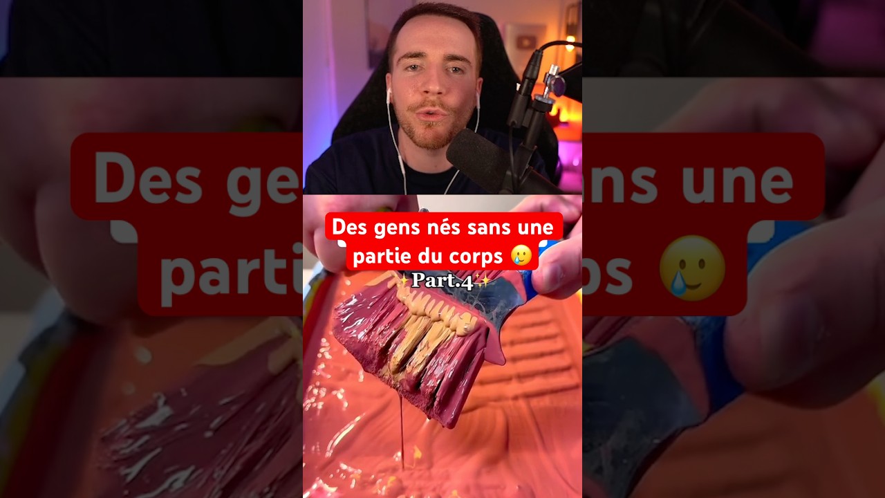 DES GENS NÉS SANS UNE PARTIE DU CORPS 😢