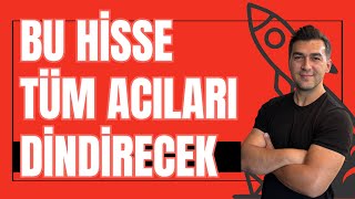 Bu Hi̇sse Tüm Acilari Di̇ndi̇recek