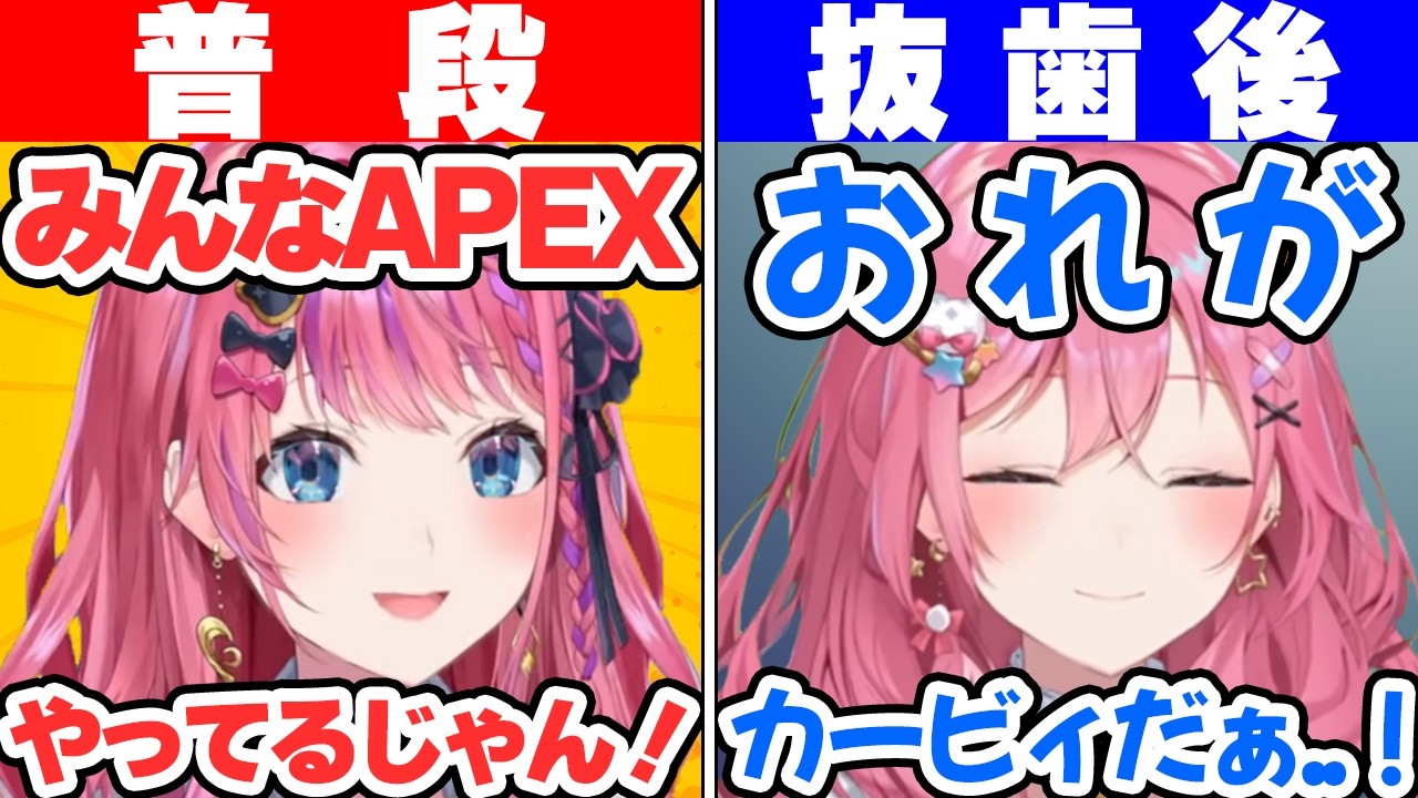 親知らずを2本抜いた結果ふにゃふにゃの歯抜けボイスになる倉持めると【にじさんじ/切り抜き】