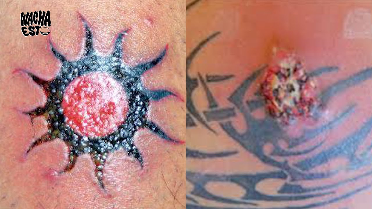 Cómo curar un tatuaje infectado? 5 consejos - Blogs MAPFRE