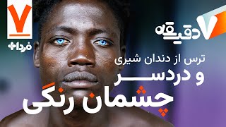 هراس از دندان‌های شیری و دردسرهای چشمان آبی