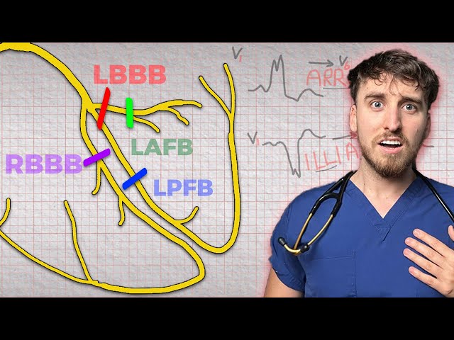 Bundle branch blocks - how to never forget them!