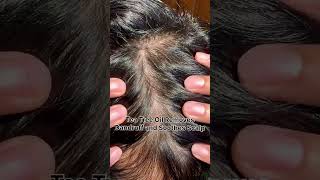 Naturali Dandruff Defence Shampoo With Cactus And Tea Tree Oil I Get Rid Of Up To 100% Of Dandruff