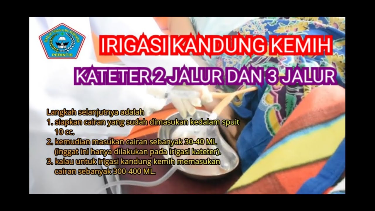 PROSEDUR TINDAKAN IRIGASI KANDUNG KEMIH 