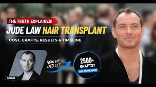 Jude Law Hair Transplant Analysis | Before, After & Hairline Timeline