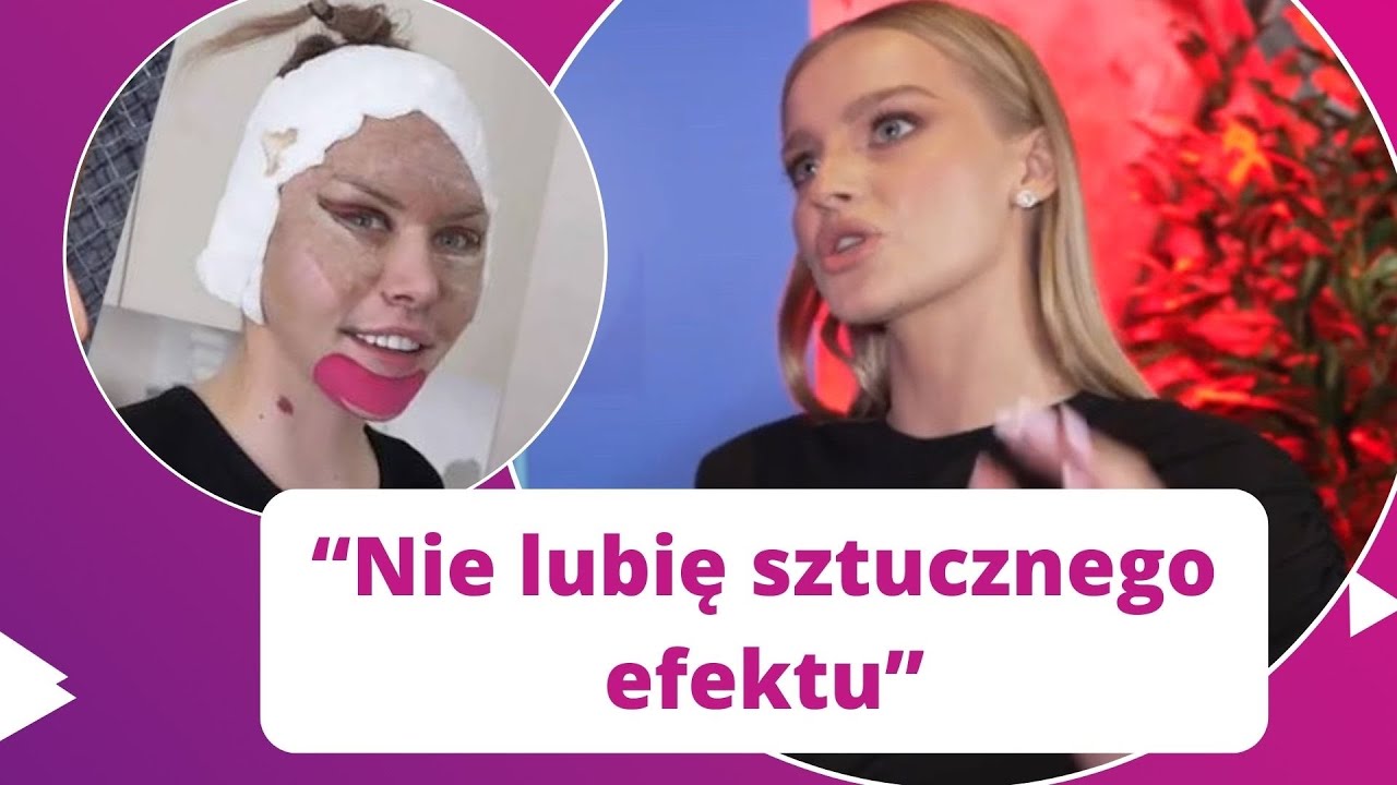 Karolina Pisarek dosadnie o liftingu twarzy Julii von Stein: ZA MŁODA 