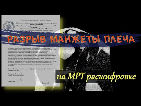 РАЗРЫВ вращательной МАНЖЕТЫ ПЛЕЧА травма плечевой манжеты на РАСШИФРОВКЕ МРТ плечевого сустава