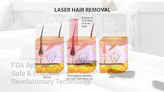 Laser Hair Removal - Permanently Remove Unwanted Hair
