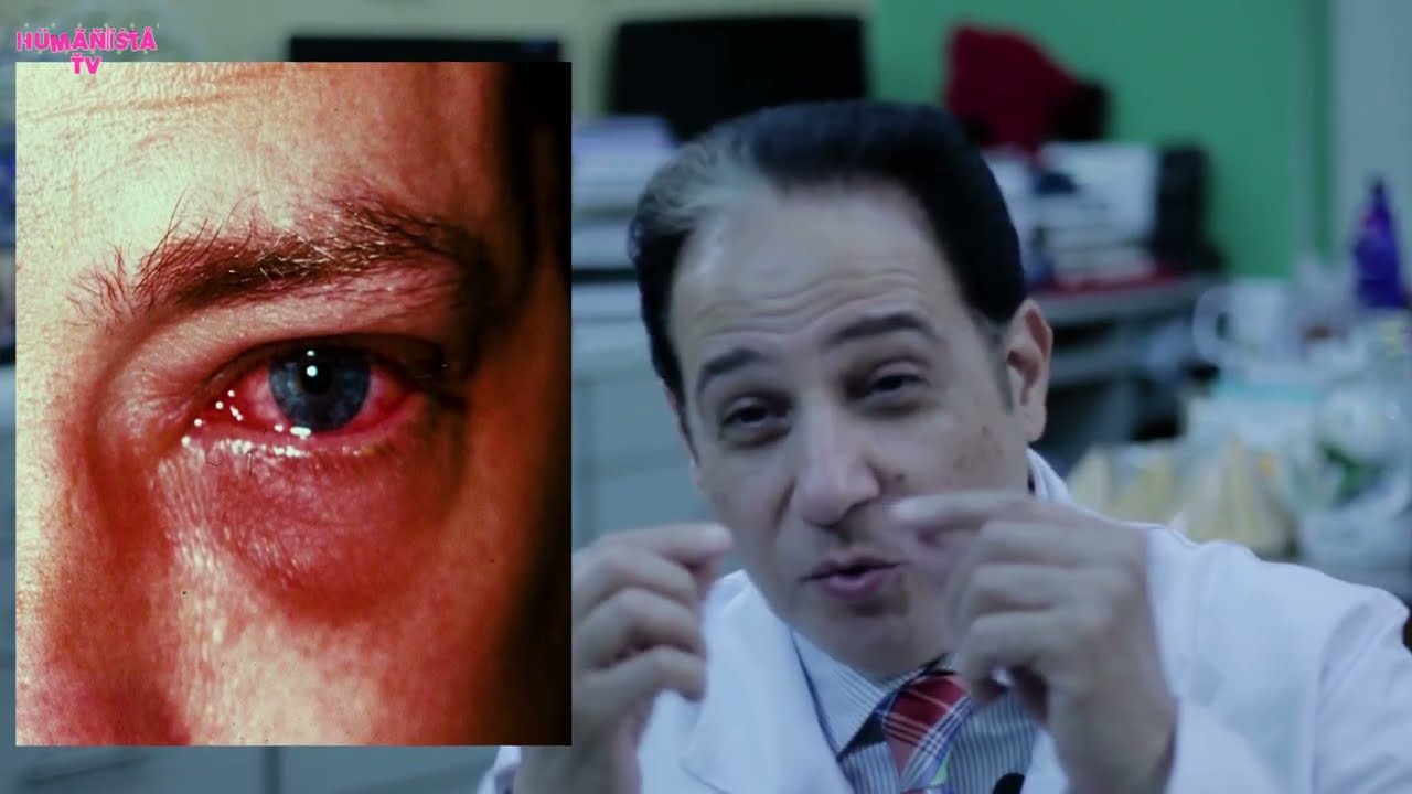 ماالفرق بين الرمد الربيعي وحساسية العين؟وعلاقتهم بالدول الحاره؟د/اشرف الهباق، استاذ طب وجراحة العيون