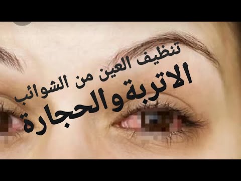 علاج فوري لتنظيف العين من الأتربة والشوائب