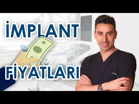 Video: Ucuz Diş İmplantları Tapmağın 10 Yolu