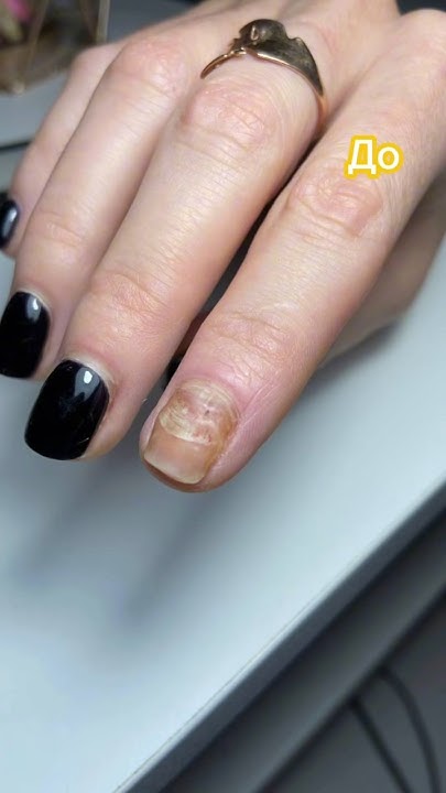 💅🏻Гель для ногтей регенерирующий Nail Therapy 30 ml. #nails # ...