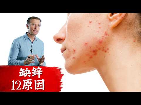 每天需要多少鋅？缺鋅12原因，如何補充鋅？ 柏格醫生 Dr Berg
