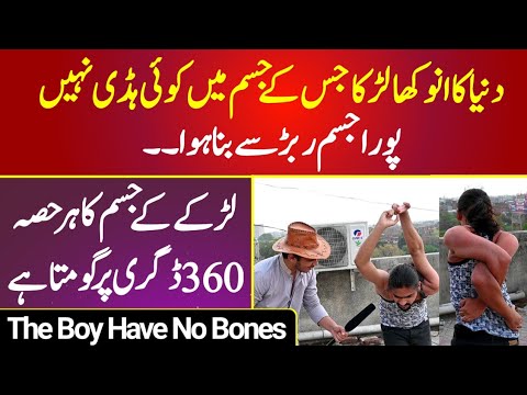 Pakistani boy have no bones in Body