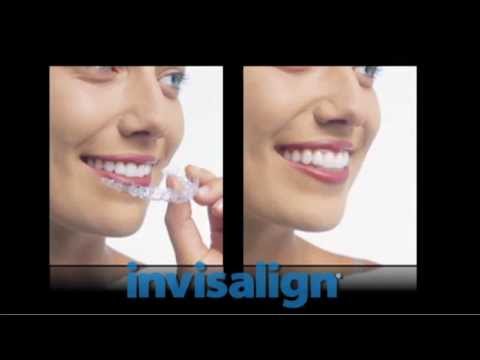 Invisalign Clear Braces in Oakland, NJ
