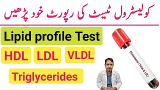 How To Read Cholesterol Test Report Urdu Hindi | Lipid Profile Test | HDL LDL & Triglycerides Test |