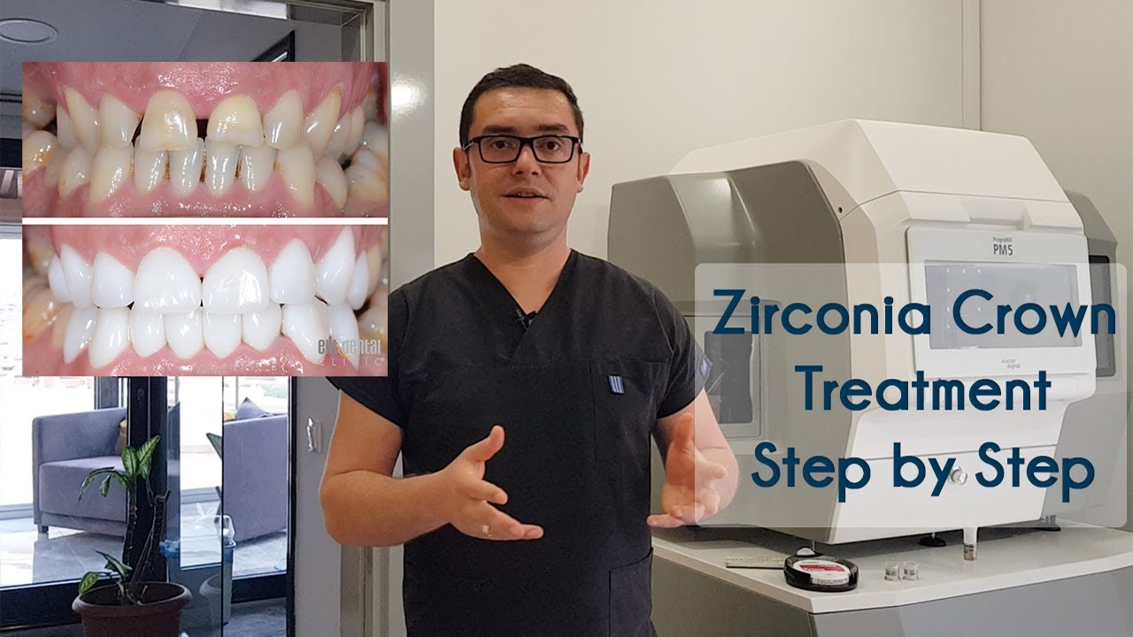 Zirconia Crown Treatment in Turkey & How We Produce Zirconia Crowns in