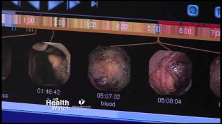 The Pill Camera – One Swallow Is All It Takes