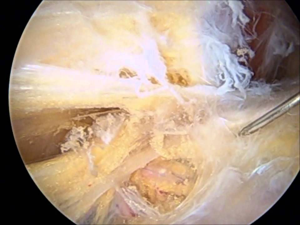 Portal ciático camera iphone 8 plus apk