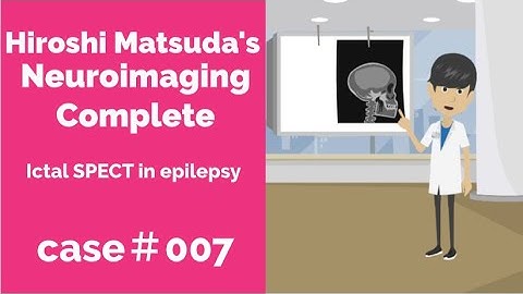 Pharmacokinetics of brain perfusion SPECT tracer