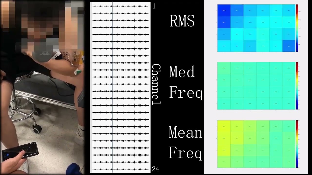 Stretchable surface electromyography electrode array patch. Supplemental 9