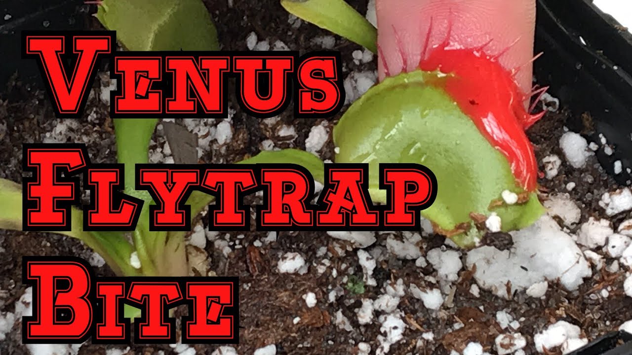 Can a Venus flytrap hurt you?