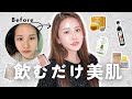 【最強】美肌と透明感を手に入れる！アンチエイジングにおすすめのインナーケア・サプリを紹介