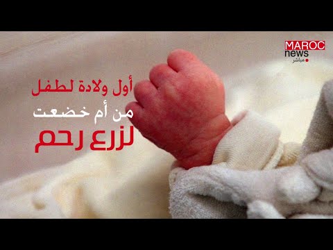 بارقة أمل أول ولادة لطفل من أم خضعت لزرع رحم في فرنسا