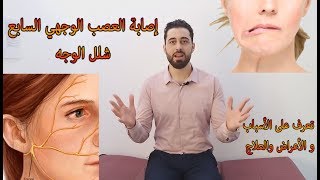 شلل العصب السابع شلل الوجه الأعراض والأسباب طرق الوقاية و العلاج