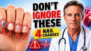 Famous Don't Ignore These 4 Nail Changes: They Could Be Warning Signs of a Heart Attack Profile