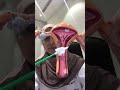 ماهي الفائدة من عمل مسحة عنق الرحم اعرفيها الآن