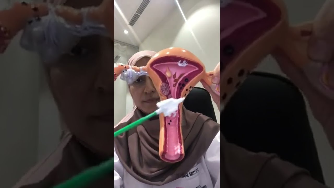 ماهي الفائدة من عمل مسحة عنق الرحم ؟ اعرفيها الآن