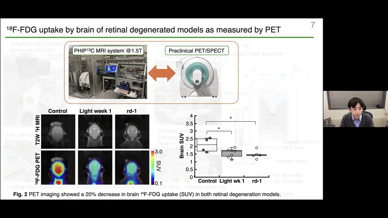 Brain metabolic alterations in murine models of retinal degeneration using parahydrogen-polarized...