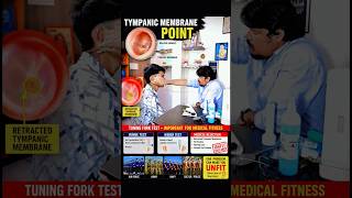 temponic membrane Hearing Loss medical unfit point (APMC) agra pre medical center #sscgd #medical