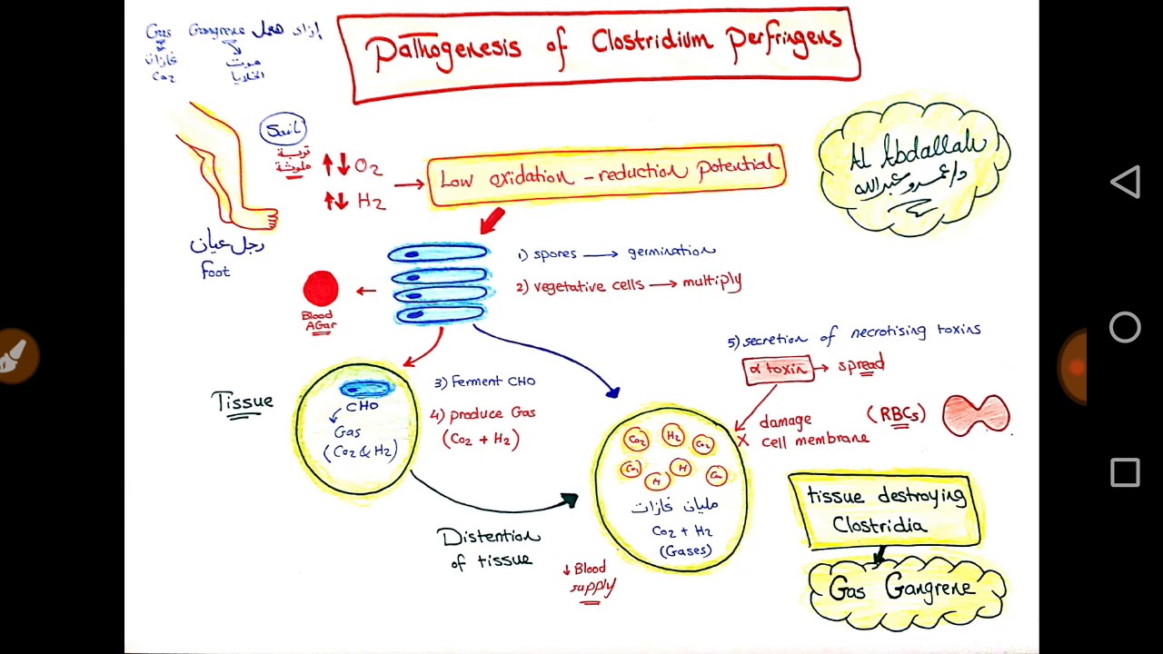 Clostridium Perfringens | Dr Amr Abdallah