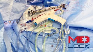Surgical Overview, SurgiLock Safety Platform, OR Efficiency, Needle Stick Safety Platform