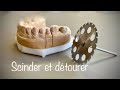 Scinder et dtourer des modles prothesedentaire