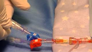 UAC Guidelines using Self-Venting Syringes(VTS_01_1).VOB