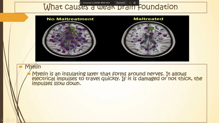 Neurosequential model