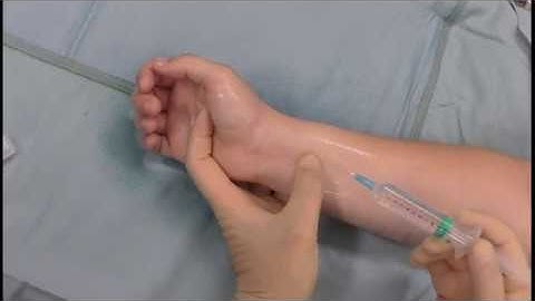 Landmark Technique for a Wrist Block