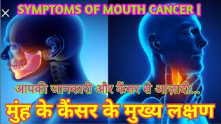 मुंह के कैंसर के मुख्य लक्षण | Symptoms Of Mouth Cancer @NirdoshTechOnco