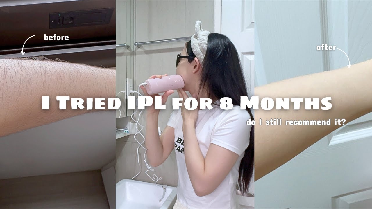 I tried IPL for 8 months - do I still recommend it?