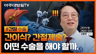 간암 2탄) 간암 수술의 모든 것! 혈액형이 달라도… 간이식이 가능할까🩸 간이식 및 간담도외과 김봉완 교수 [아주대병원TV]