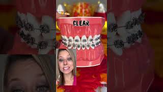 Avoid These Braces Colors Explained Tip For Fall